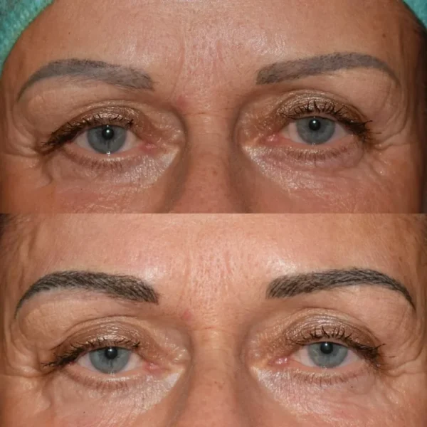 Microblading 7