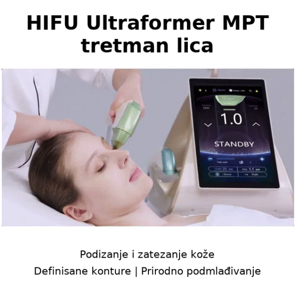 HIFU Ultraformer MPT tretman lica